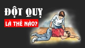 Bệnh Đột quỵ cực kỳ nguy hiểm? – Hiểu rõ trong 5 phút