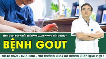 Bệnh Gout Nguy Hiểm Như Thế Nào? Cách Phòng Biến Chứng? | SKĐS