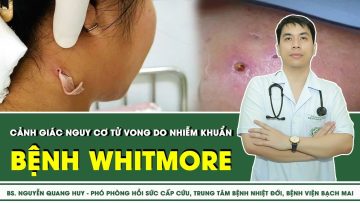 Bệnh whitmore tăng cao sau lũ lụt,  cảnh giác nguy cơ tử vong do nhiễm khuẩn | SKĐS