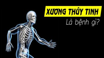 Bệnh Xương  thủy tinh là gì? Hiểu rõ trong 5 phút