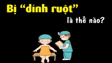 Bị dính ruột là thế nào? Tại sao phải tập đi để không dính ruột?