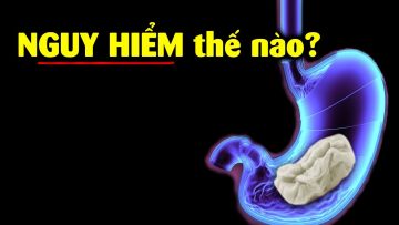 Bụng bạn sẽ ra sao khi nuốt kẹo cao su ??