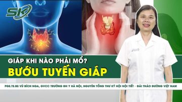 Bướu tuyến giáp khi nào phải mổ? | SKĐS