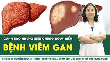 CẢNH BÁO NHỮNG BIẾN CHỨNG NGUY HIỂM CỦA BỆNH VIÊM GAN | SKĐS