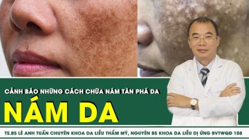 Cảnh Báo Những Cách Chữa Nám Tàn Phá Da | SKĐS