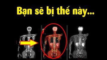 Chuyện gì xảy ra khi ăn chất Phóng xạ – nguy hiểm thế nào ??