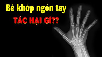 Có đúng bẻ khớp ngón tay rất nguy hiểm không?