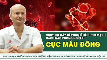 Cục máu đông – Nguy cơ gây tử vong ở bệnh tim mạch cách nào phòng ngừa? | SKĐS