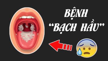 Hiểu rõ về bệnh Bạch hầu trong 5 phút
