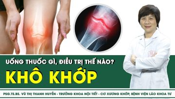 Khô khớp uống thuốc gì, điều trị thế nào? | SKĐS