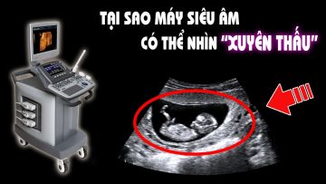 Máy siêu âm chụp ảnh xuyên thấu thế nào? Hiểu rõ trong 5 phút