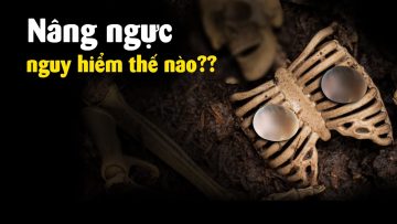Nâng ngực hay cuộc chơi với tử thần?