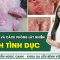 Những Bệnh Lây Qua Đường Tình Dục Phổ Biến – Dấu Hiệu Và Cách Phòng Lây Nhiễm | SKĐS