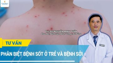 Phân biệt sốt phát ban ở trẻ với bệnh sởi