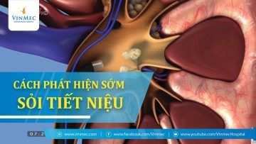 Phát hiện và điều trị sớm sỏi tiết niệu