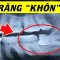 Răng khôn – Răng số 8 có gì đặc biệt? Hiểu rõ trong 5 phút