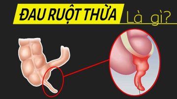 Sao ruột thừa lại nguy hiểm? Hiểu rõ trong 5 phút