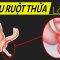 Sao ruột thừa lại nguy hiểm? Hiểu rõ trong 5 phút