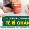 Tê bì chân tay do thoái hoá cột sống chữa thế nào? | SKĐS