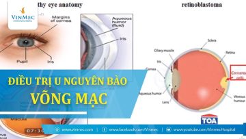 Thành công điều trị u nguyên bào võng mạc ở trẻ em