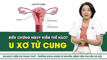 U xơ tử cung biến chứng nguy hiểm thế nào? | SKĐS