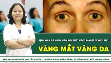 Vàng Mắt Vàng Da – Bệnh Gan Đã Nguy Hiểm Đến Mức Nào? Làm Gì Để Điều Trị? | SKĐS