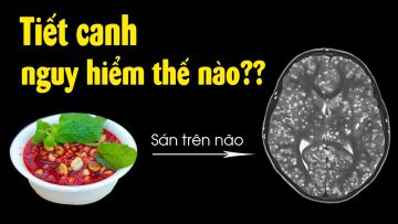 Xem video này bạn sẽ không còn dám ăn tiết canh!