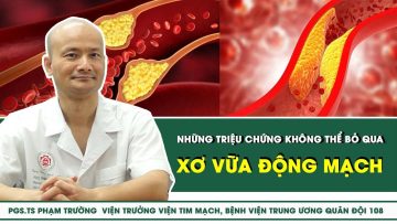 Xơ vữa động mạch: Những triệu chứng không thể bỏ qua | SKĐS