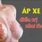 Áp xe vú điều trị như thế nào?