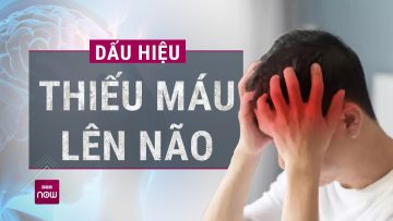 🚫 Bạn có đang bỏ qua những dấu hiệu báo động của thiếu máu lên não? | VTC Now