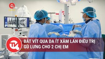 Bắt vít qua da ít xâm lấn điều trị gù lưng cho 2 chị em | Truyền hình Quốc hội Việt Nam