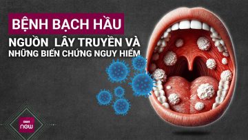 Bệnh bạch hầu: Nguồn lây truyền và những biến chứng nguy hiểm | VTC Now