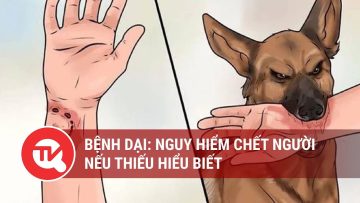 Bệnh dại: Nguy hiểm chết người nếu thiếu hiểu biết | Truyền hình Quốc hội Việt Nam