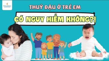 Bệnh thủy đậu ở trẻ em có nguy hiểm không?