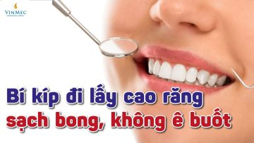 Bí kíp đi lấy cao răng sạch bong, không ê buốt