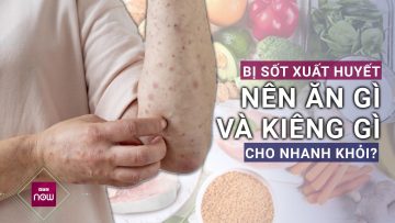 Bị sốt xuất huyết nên ăn gì và kiêng gì cho nhanh khỏi? | VTC Now