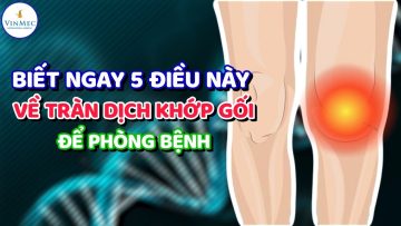 Biết ngay 5 điều này về tràn dịch khớp gối để phòng bệnh | BS Võ Sỹ Quyền Năng, BV Vinmec Times City