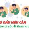 Biểu hiện khi trẻ sốt cần đi khám NGAY trong 24h