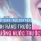 Buổi sáng thức dậy nên đánh răng trước hay uống nước trước? | VTC Now