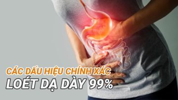 Các dấu hiệu chính xác loét dạ dày 99%| Bác sĩ CKI Đồng Xuân Hà – Vinmec Hạ Long