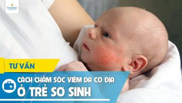 Cách chăm sóc viêm da cơ địa ở trẻ sơ sinh