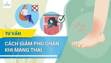 Cách giảm phù chân khi mang thai