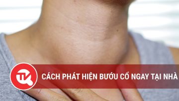 Cách phát hiện bướu cổ ngay tại nhà | Truyền hình Quốc hội Việt Nam