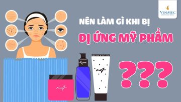 Cần làm gì ngay khi dị ứng mỹ phẩm?| BS Nguyễn Thị Thu Trang, BV Vinmec Central Park