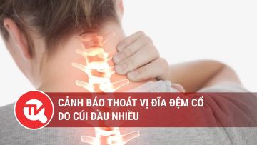 Cảnh báo thoát vị đĩa đệm cổ do cúi đầu nhiều | Truyền hình Quốc hội Việt Nam