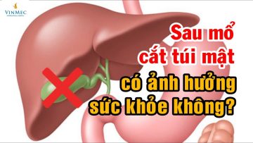 Cắt túi mật có ảnh hưởng sức khỏe không? BS Vũ Văn Quân, BV Vinmec Hải Phòng