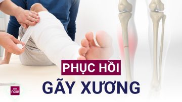 Chẳng may bị gẫy xương: Đây là bí quyết phục hồi thần tốc! | VTC Now