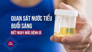 Chỉ mất 5 giây để quan sát nước tiểu vào buổi sáng biết ngay đang mắc bệnh gì | VTC Now