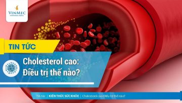 Cholesterol cao: Điều trị thế nào?