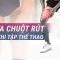 Chuột rút ư? Chuyện nhỏ: Đây là bí quyết xử lý cơn đau chỉ trong tích tắc | VTC Now